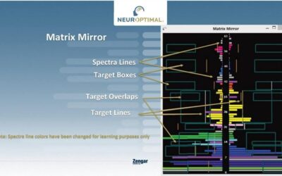 Dallo Schermo al Cervello: Come Funzionano le TFEs (ma non guardarle!)